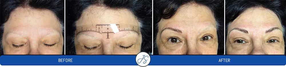 Microblading Treatment Near Me in Middleburg Heights, OH Microblading Treatment Near Me in Middleburg Heights, OH