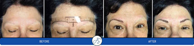 Microblading Treatment Near Me in Middleburg Heights, OH Microblading Treatment Near Me in Middleburg Heights, OH