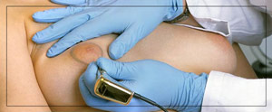 Areola Repigmentation Specialist Near Me in Cleveland, OH Areola Repigmentation Specialist Near Me in Cleveland, OH