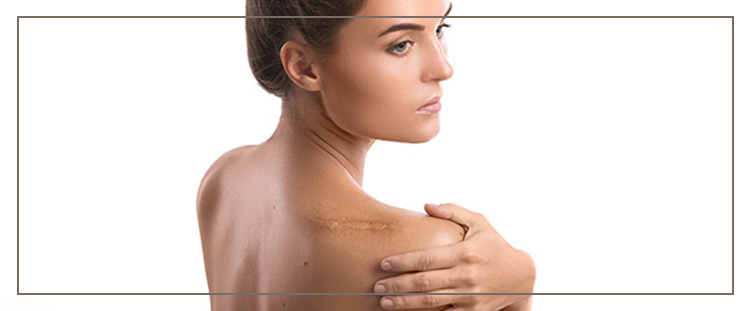 Top Rated Scar Camouflage Artist Near Me in Cleveland OH Top Rated Scar Camouflage Artist Near Me in Cleveland OH