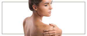 Top Rated Scar Camouflage Artist Near Me in Cleveland OH Top Rated Scar Camouflage Artist Near Me in Cleveland OH