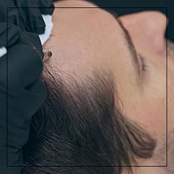 Scalp Micropigmentation Near Me in Middleburg Heights, OH