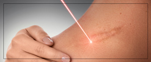Scar Cover-Up Treatment Specialist Near Me in Cleveland, OH Scar Cover-Up Treatment Specialist Near Me in Cleveland, OH
