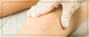 Medical Scar Camouflage Tattooing Near Me in Cleveland, OH Medical Scar Camouflage Tattooing Near Me in Cleveland, OH