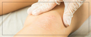 Micropigmentation Scar Camouflage Near Me in Cleveland, OH Micropigmentation Scar Camouflage Near Me in Cleveland, OH