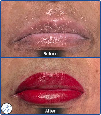 Full Lip Color Before and After Client Photos of Jaudon Sunde in Cleveland, OH 