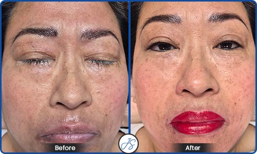 Full Face Eyes, Brows & Lips Before and After Client Photos of Jaudon Sunde in Cleveland, OH 