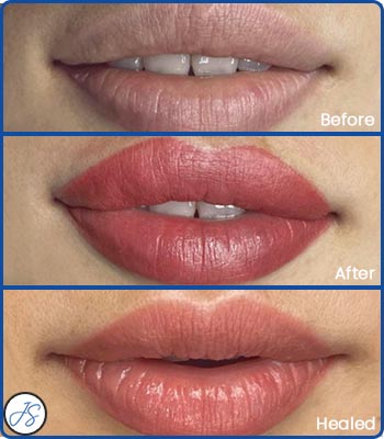 Full Lip Color Before and After Client Photos of Jaudon Sunde in Cleveland, OH 
