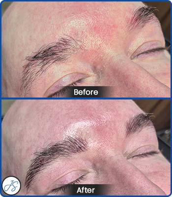 Microblading Brows Before and After Client Photos of Jaudon Sunde in Cleveland, OH 
