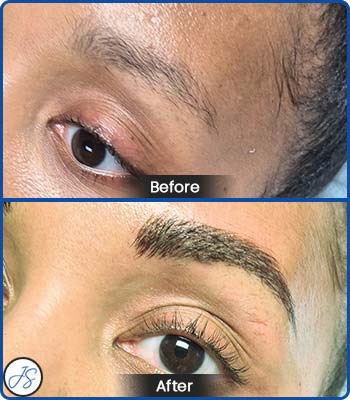 Microblading Brows Before and After Client Photos of Jaudon Sunde in Cleveland, OH 