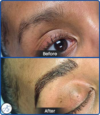 Microblading Brows Before and After Client Photos of Jaudon Sunde in Cleveland, OH 