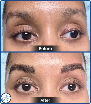 Microblading Brows Before and After Client Photos of Jaudon Sunde in Cleveland, OH 