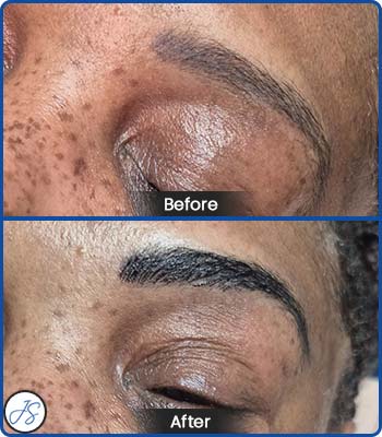 Microblading Brows Before and After Client Photos of Jaudon Sunde in Cleveland, OH 