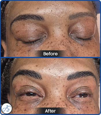 Microblading Brows Before and After Client Photos of Jaudon Sunde in Cleveland, OH 