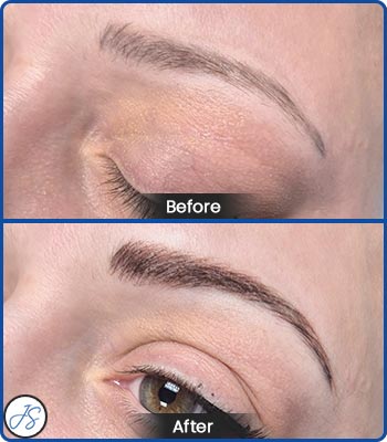 Microblading Brows Before and After Client Photos of Jaudon Sunde in Cleveland, OH 