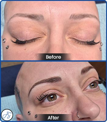 Microblading Brows Before and After Client Photos of Jaudon Sunde in Cleveland, OH 